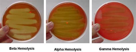blood agar plate results|Update on blood cultures: how to obtain, process, report, and .